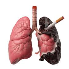 Description: A human lungs with a cigarette in it

AI-generated content may be incorrect.
